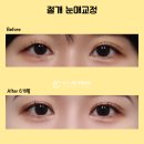 아이그램성형외과 이미지