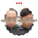 모웰 - 중랑구 망우로 316 | [모웰] 자연스러운 남자부분가발