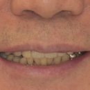 바름치과기공소 이미지