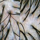 지성마을 | 소사역 피부샵 올가드림뷰티, 지성피부의 두피&amp;모공 디톡스 후기