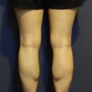 닥터코코의원 이미지