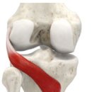 헬스피티 이미지