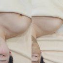 경산푸드 1 호점 | 경산피부관리 ㅣ트러블 색소관리 수분관리 받고 온 후기 물오른뷰티 경산점