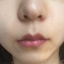 뷰티앤영의원 이미지