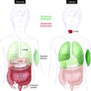 Re:Glutamine and cancer: cell biology, physiology, and clinical opportunities 이미지