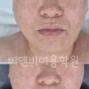윤앤비 | [서산미용학원] 얼굴 윤각실무 교육!!