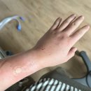 한아름 | 양산 한아름 산부인과 병원 경산모 제왕절개 후기