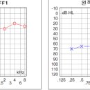 하단독일보청기 이미지