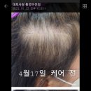 두피·탈모태후사랑하남점 이미지