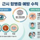 바른아이안경, 콘택트 이미지