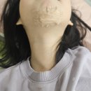 [위례] 아이작성형외과의원 :: 아이 상처 봉합 병원 추천