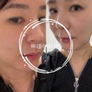 동탄에스테틱 허니블리에스테틱 동탄점 피부관리 정착