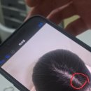 모인(Moin)헤어 | 건대두피문신 l 여자가르마smp 솔직 후기 (모인smp)