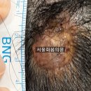 서울화봄의원 네이버블로그