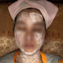 천호한의원 | [천호편평사마귀제거 / 천호쥐젖제거] 재생테이프가 필요 없는 천호편평사마귀제거한의원 후기