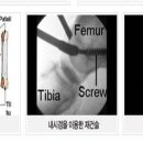 겨울관절-무릎부터 발가락까지 운동 중 관절손상 주의보 이미지