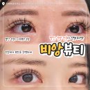 롯데마트 전주점 | [전주] 눈썹 잔흔 제거 3회차 "비앙뷰티" 제거 통증 후유증 내돈내산 솔직후기