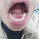 에이치피알 | APLGO건강식품!