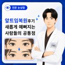 새롭게 | 앞트임복원후기 새롭게 예뻐지는 사람들의 공통점