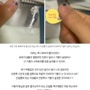 식약처(식품의약품안전처) 게시글 신고 - 과대광고, 약사법 위반