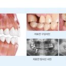 라임나무치과병원 네이버블로그
