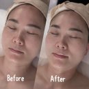 와우브레인 | 진해 피부관리_바룸앤블룸 멜라소닉 플라즈마 미백관리 후기 40대 확실한 피부 변화