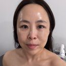 온리피부관리 | 의정부역 피부관리 뷰티온리 자극없는 수분탄력관리 후기