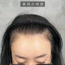 미소헤어스케치 | 스트레스 끝! 자연스러움의 끝판왕, 선릉 두피문신 리얼 후기 (ft. 강남구청 두피문신, 대치동 두피문신)