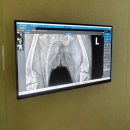 오산동물병원 | [경기도/오산] 24시 하나린동물병원 포메라니안 슬개골수술 후기(수술당일~일주일차)