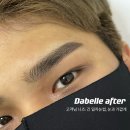 탑헤어라인 이미지