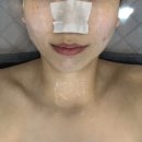 두산동피부관리 아비에피부앤왁싱 대구본점 | 물방울리프팅관리 받고 온 후기 !