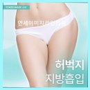 연세이미지라인의원 네이버블로그