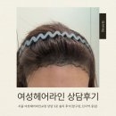 모플러스성형외과의원 | 서울 여성헤어라인교정 모발이식 상담 3곳 솔직후기(압구정·신사역 중심)
