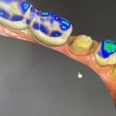 화이트디지털치과기공소 이미지