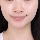 효소엔자임