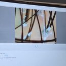 올림픽로613 | 에스테틱 송파잠실교육센터]염색 후 뒤집어진 두피 숲칼프 교육센터 원장님 실력에 반해버린 찐 방문 후기