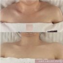 아름다운피부관리 네이버블로그