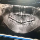 서부라온치과병원 이미지