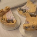 청플란트치과의원 이미지