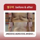 바른체형작은얼굴케어
