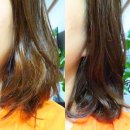 보윤한의원 | 청담동 한의원 탈모 트리트먼트팩 사용후기