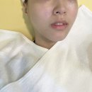 바로미의원 | 청담역 피부과 모공지우개 알에프포샵 후기