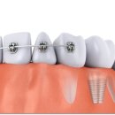 맑은플란트치과의원 이미지