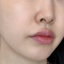 바이오아 티들샷 T나게 모공 좋아지는 모공쓱싹에센스 솔직후기