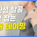 어깨에 통증이 있고 습관성 탈골이 있다면 어깨 테이핑 이미지