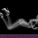 손태석 발가락운동용구 이미지