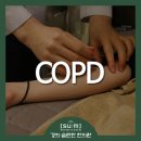 대구COPD 진단의 주 원인은 흡연 이미지