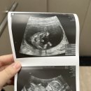 세상의반여성의원 | [삼성역 산부인과] 입체초음파 봤던 세상의반여성의원에서 산후검진 후기