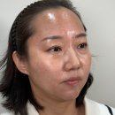 새록뷰티 | 40~50대 피부관리, 줄기세포 앰플 테스트로 변화가 생겼다!