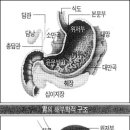 위암에 대한 지식 이미지